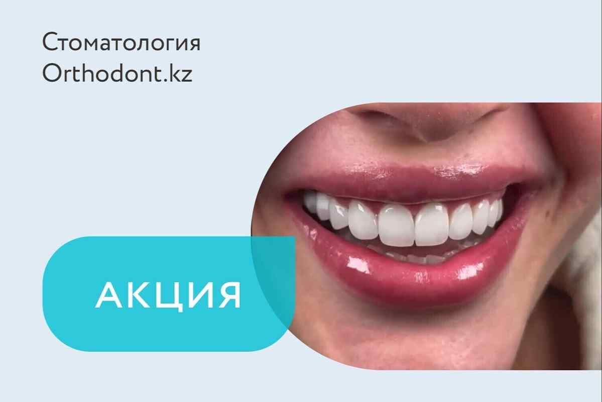 Акция «Реставрация зубов по специальной цене»