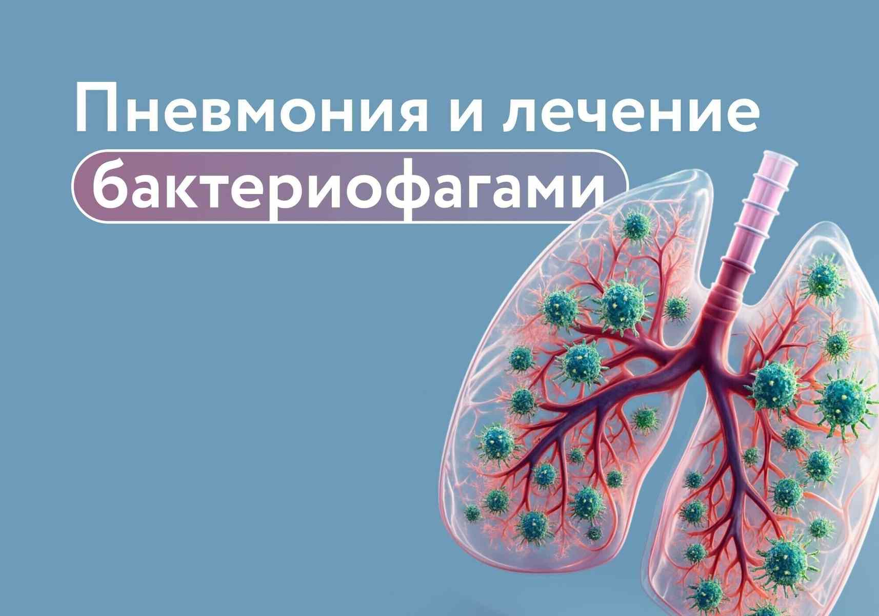 Что изменилось в лечении пневмонии: роль бактериофагов рядом с антибиотиками