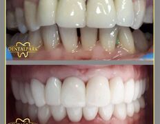 Стоматологическая клиника DentalPark (ДенталПарк), Наши работы - фото 10