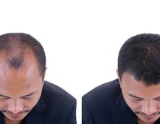 Медицинский центр лечения волос и кожи головы АМД Лаборатории, Примеры работ - фото 15