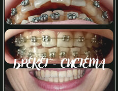 Стоматологическая клиника DentalPark (ДенталПарк), Наши работы - фото 3
