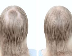 Медицинский центр лечения волос и кожи головы АМД Лаборатории, Примеры работ - фото 14