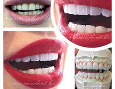 Сеть круглосуточных стоматологических клиник Eurodent (Евродент), Примеры работ - фото 4