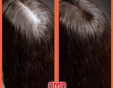 Медицинский центр лечения волос и кожи головы АМД Лаборатории, Примеры работ - фото 3