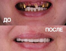 Стоматология My Dent (Май Дент), Примеры работ - фото 11