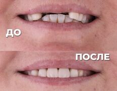 Стоматология My Dent (Май Дент), Примеры работ - фото 15