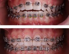 Стоматология My Dent (Май Дент), Примеры работ - фото 5