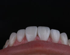 Стоматологическая клиника Dental Practice Aesthetic Centre (Дентал Практис Эстетик Центр), Наши работы - фото 20