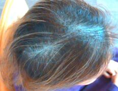 Медицинский центр лечения волос и кожи головы АМД Лаборатории, Примеры работ - фото 10