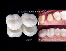 Сеть круглосуточных стоматологических клиник Eurodent (Евродент), Примеры работ - фото 10