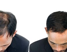 Медицинский центр лечения волос и кожи головы АМД Лаборатории, Примеры работ - фото 12