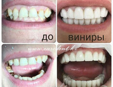 Сеть круглосуточных стоматологических клиник Eurodent (Евродент), Примеры работ - фото 9