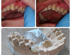 Сеть круглосуточных стоматологических клиник Eurodent (Евродент), Примеры работ - фото 13