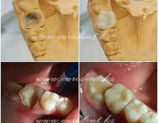 Сеть круглосуточных стоматологических клиник Eurodent (Евродент), Примеры работ - фото 12
