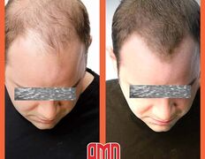 Медицинский центр лечения волос и кожи головы АМД Лаборатории, Примеры работ - фото 2