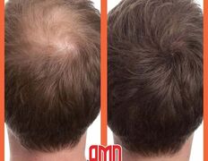 Медицинский центр лечения волос и кожи головы АМД Лаборатории, Примеры работ - фото 1