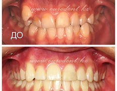 Сеть круглосуточных стоматологических клиник Eurodent (Евродент), Примеры работ - фото 1