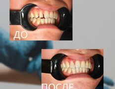 Стоматология Зуб`ОК, Наши работы - фото 1