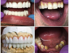 Сеть круглосуточных стоматологических клиник Eurodent (Евродент), Примеры работ - фото 6