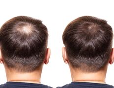 Медицинский центр лечения волос и кожи головы АМД Лаборатории, Примеры работ - фото 6