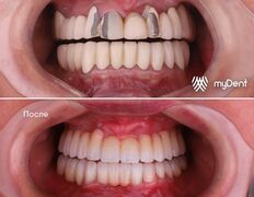 Стоматология My Dent (Май Дент), Примеры работ - фото 13
