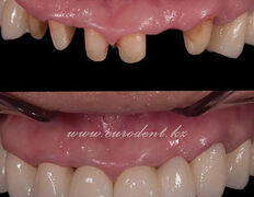 Сеть круглосуточных стоматологических клиник Eurodent (Евродент), Примеры работ - фото 3