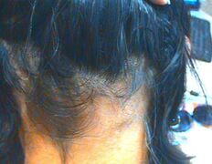 Медицинский центр лечения волос и кожи головы АМД Лаборатории, Примеры работ - фото 19