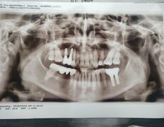 Стоматологический кабинет Айнабулак Дент, Примеры работ - фото 14