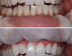 Стоматологическая клиника DentalPark (ДенталПарк), Наши работы - фото 11