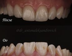 Стоматологическая клиника Dental Practice Aesthetic Centre (Дентал Практис Эстетик Центр), Наши работы - фото 8