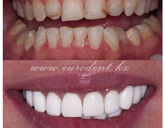 Сеть круглосуточных стоматологических клиник Eurodent (Евродент), Примеры работ - фото 11