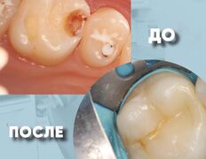 Стоматология My Dent (Май Дент), Примеры работ - фото 20