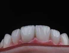 Стоматологическая клиника Dental Practice Aesthetic Centre (Дентал Практис Эстетик Центр), Наши работы - фото 14