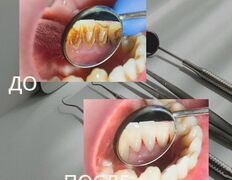 Стоматология Зуб`ОК, Наши работы - фото 3