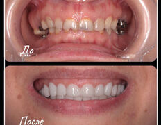 Стоматологическая клиника DentalPark (ДенталПарк), Наши работы - фото 1