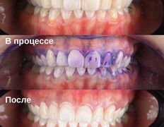 Стоматология Doctor-Stom (Доктор-Стом), Чистка зубов - фото 1