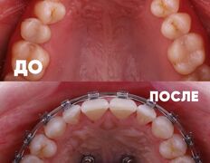 Стоматология My Dent (Май Дент), Примеры работ - фото 8