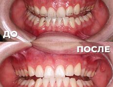 Стоматология My Dent (Май Дент), Примеры работ - фото 14