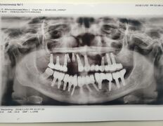 Стоматологический кабинет Айнабулак Дент, Примеры работ - фото 16