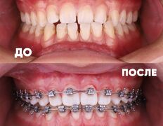 Стоматология My Dent (Май Дент), Примеры работ - фото 4
