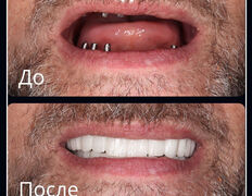 Стоматологическая клиника DentalPark (ДенталПарк), Наши работы - фото 2