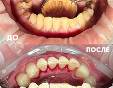 Стоматология My Dent (Май Дент), Примеры работ - фото 18