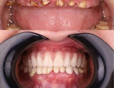 Стоматология My Dent (Май Дент), Примеры работ - фото 19