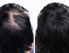 Медицинский центр лечения волос и кожи головы АМД Лаборатории, Примеры работ - фото 13