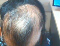 Медицинский центр лечения волос и кожи головы АМД Лаборатории, Примеры работ - фото 17