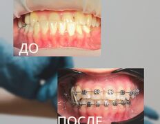 Стоматология Зуб`ОК, Наши работы - фото 2