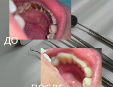 Стоматология Зуб`ОК, Наши работы - фото 4