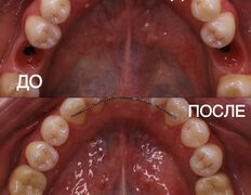 Стоматология My Dent (Май Дент), Примеры работ - фото 12