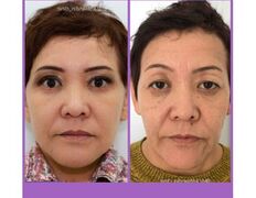 null Клиника пластической хирургии доктора Кобландина, Наши работы - фото 18