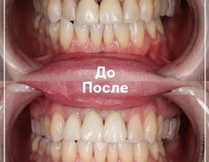 Стоматологическая клиника DentalPark (ДенталПарк), Наши работы - фото 7